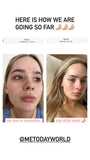 Mānuka Active+ - Blemish Gel